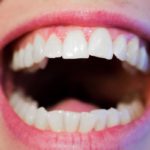 White teeth
