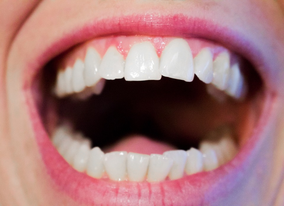 White teeth