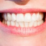 White teeth