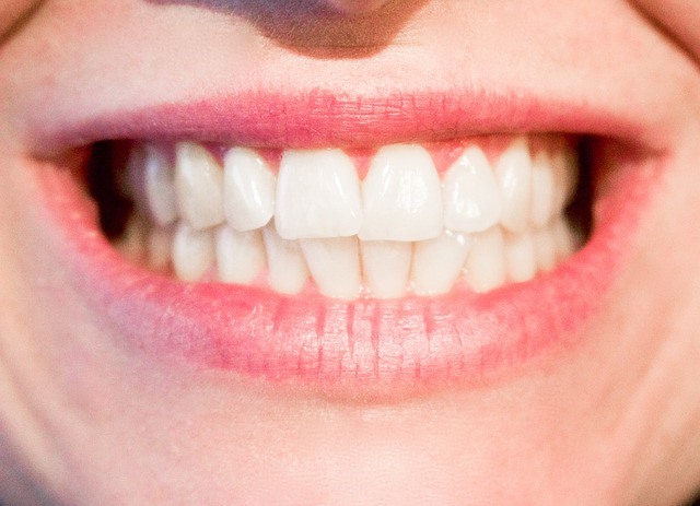 White teeth
