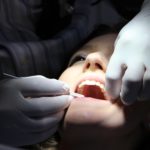 tooth extraction