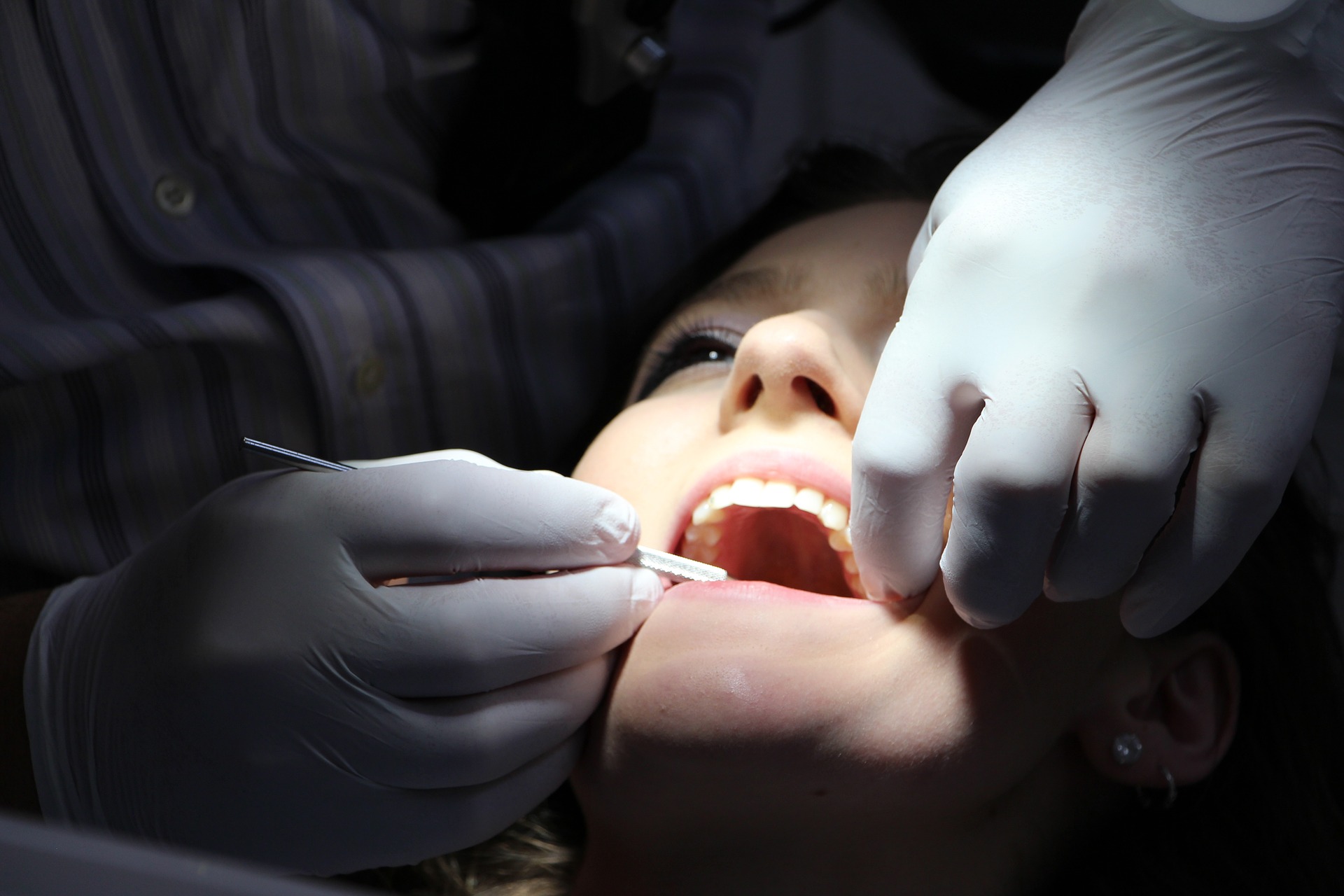 tooth extraction